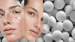 how-effective-are-salicylic-acid-peels-for-acne-prone-skin